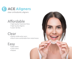 ACE Aligner: Custom Orthodontic Clear Aligners